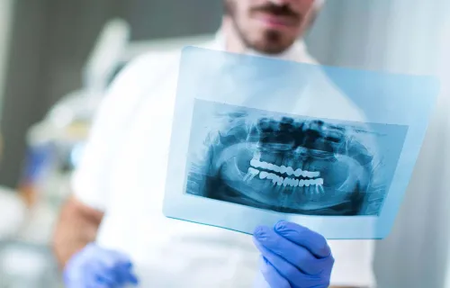 Boneprox xray jaw